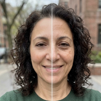 Upload a selfie and let Ageless AI apply the treatments you’re considering — right onto your own face or body.